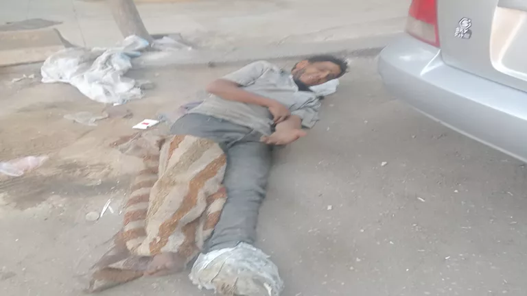 إنقاذ مشرد في الزقازيق بعد تعرضه لحالة تعفن خطيرة: تفاصيل مثيرة عن صراعه من أجل البقاء 1 إنقاذ مشرد في الزقازيق بعد تعرضه لحالة تعفن خطيرة: تفاصيل مثيرة عن صراعه من أجل البقاء